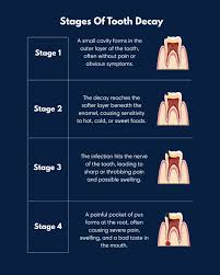 preventive dental checkup